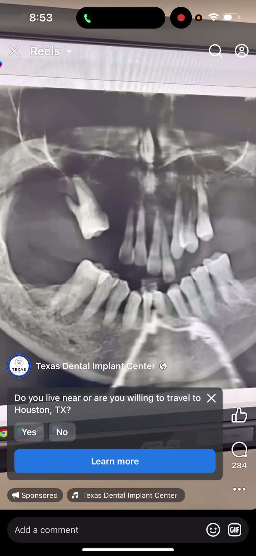 Cover for #CaughtOnCamera  Tell Texas Dental Tuville2Tv sent ya