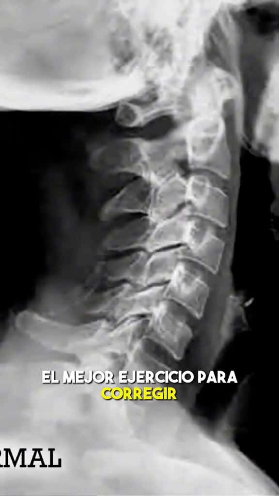 Cover for El mejor ejercicio para la rectificacin cervical   si te ha sido til guardalo y c 80000 #shortvideos