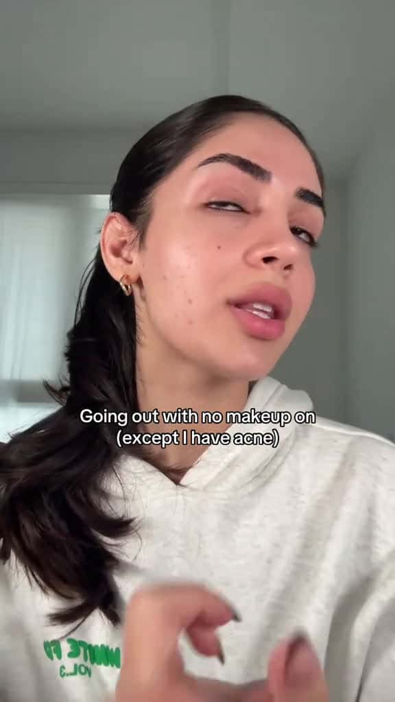 Cover for Ending the last day of this challenge with a nice hormonal breakout  ib Kim  Pete 52471 #shortvideos