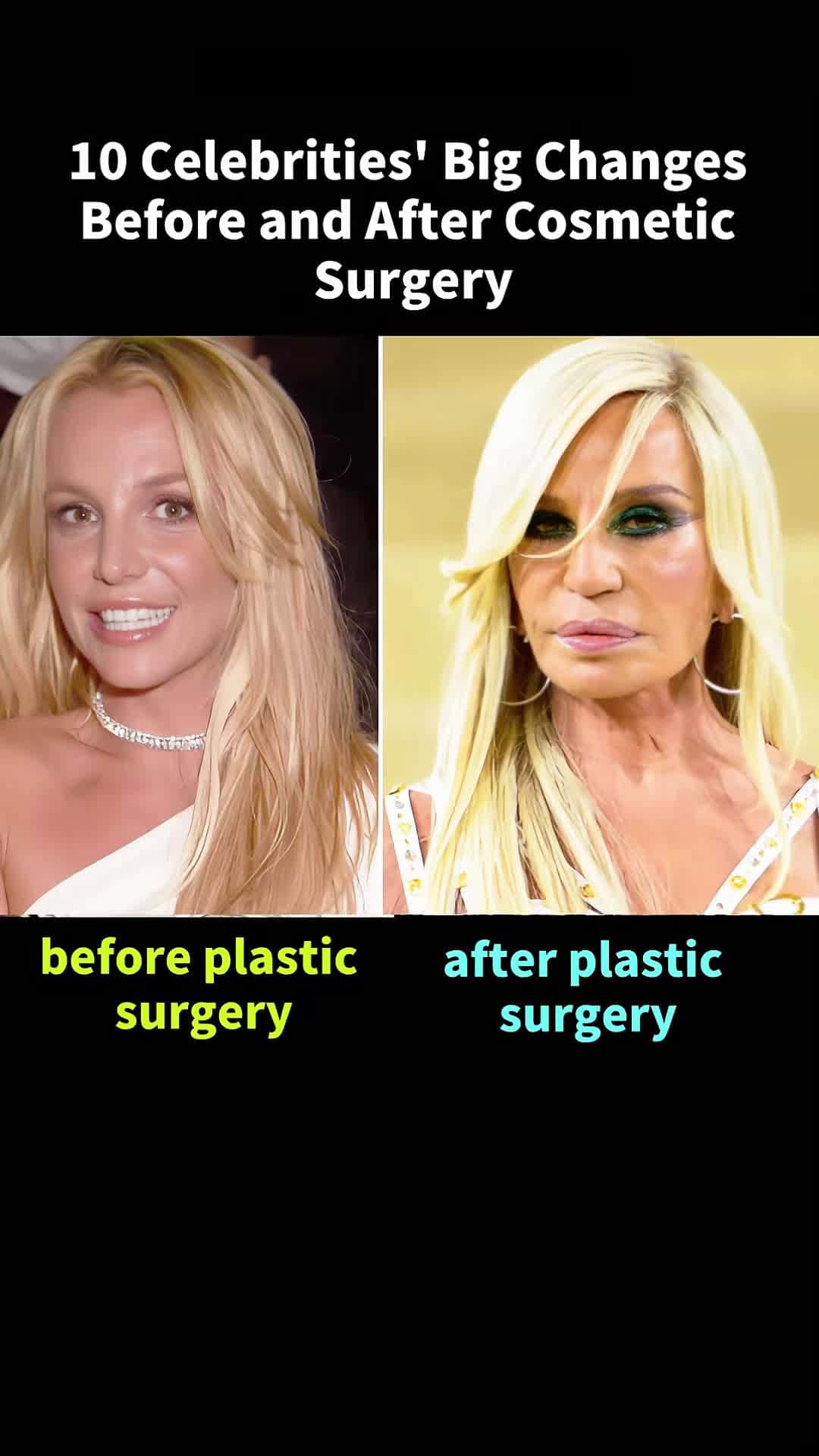 Cover for #CaughtOnCamera 10 celebrities big changes before and after cosmetic surgery #celebrity #celeb #art #cute #movie #influencer #news #makeup #instadaily #star #likeforlikes #celebrityfashion #movies #celebrities #style #music #explore #foryoupage #fyp #viral 