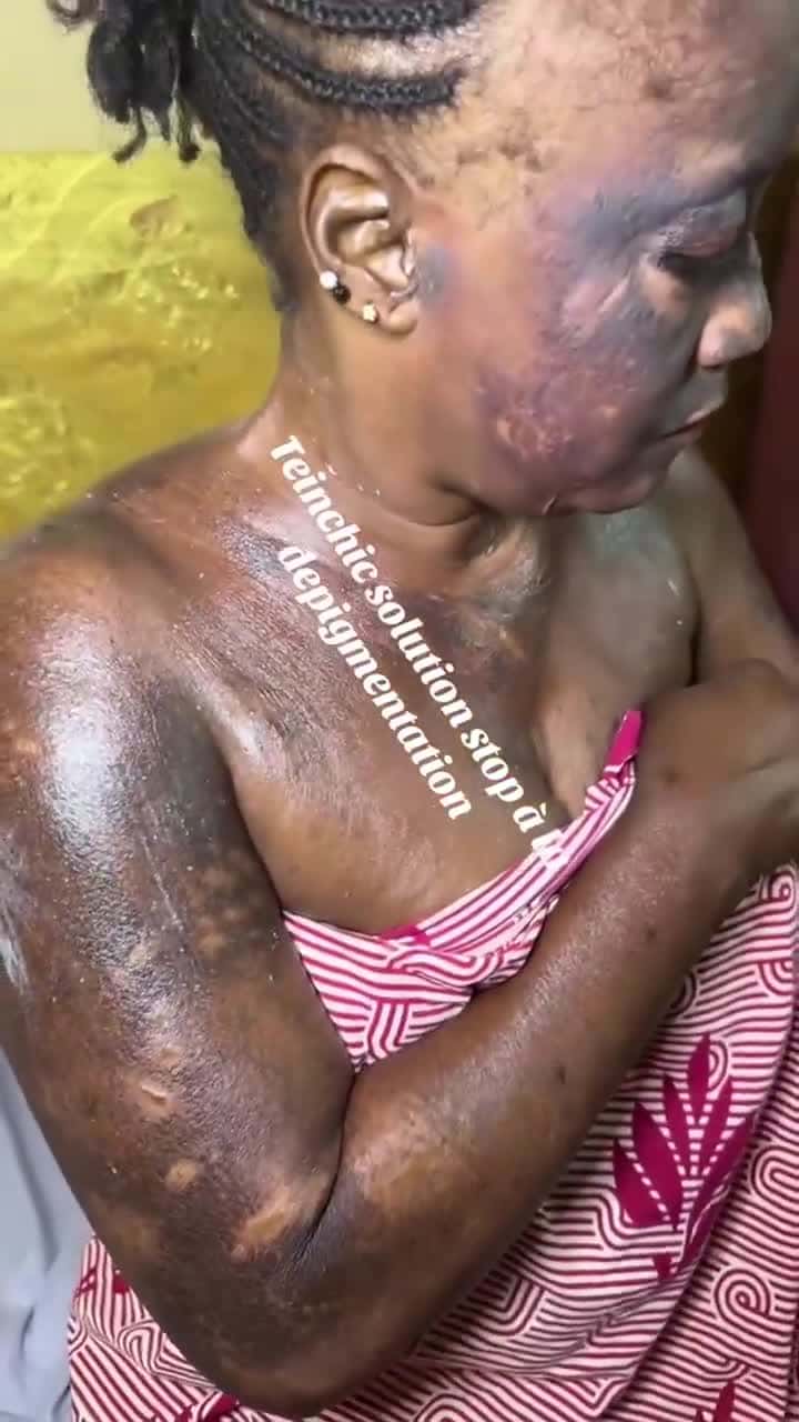 Cover for Why would you damage perfectly good skin to be lighter 🤦🏾‍♀️🤦🏾‍♀️🤬🤬#StopBleaching #BlackIsBeautiful #BlackerThaBerryThaSweeterThaJuice#JustSayNo 🙄😢😢