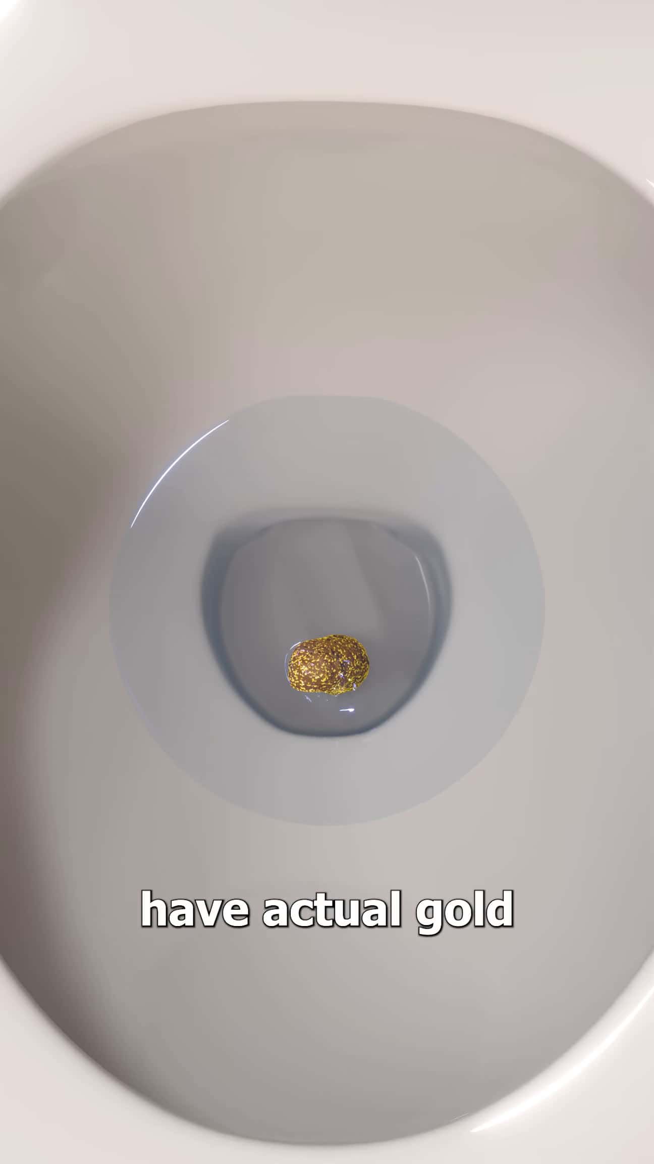 Cover for Why Some People Have Gold In Their Poop 🤔