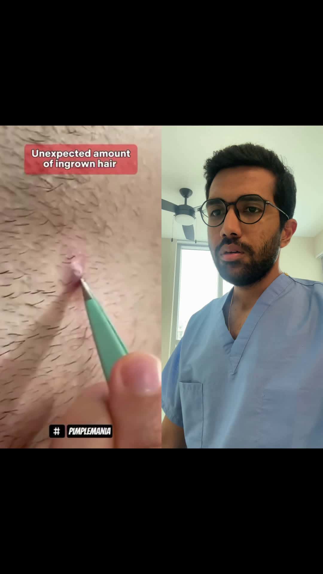 Cover for Ingrown hair removal