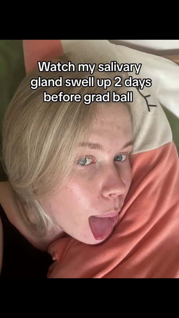 Cover for 5 years of uni for this to happen if I dont laugh ill cry fyp fyp viraltiktok funny gradua 25633 #trendingscoopz