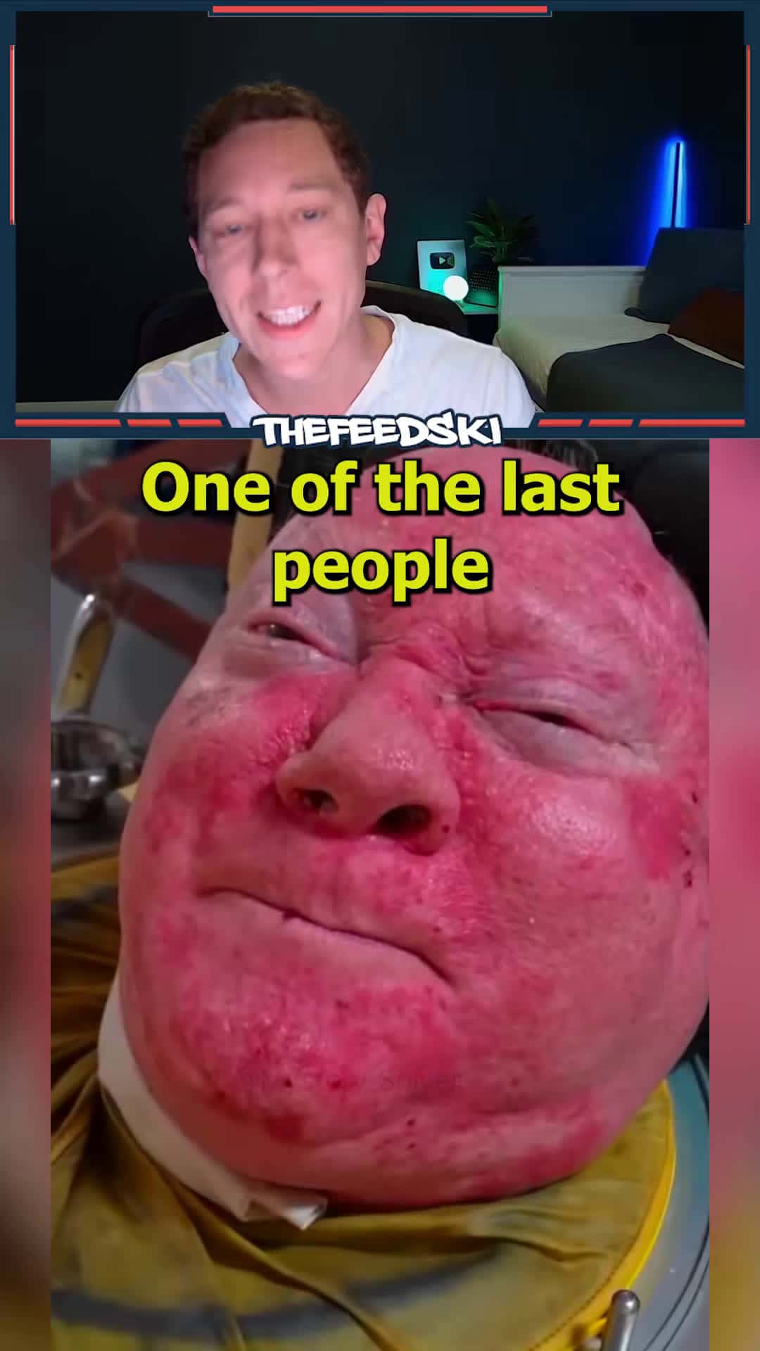 Cover for Paul Alexander, one of the last people to be living in an iron lung, has unfortunately passed away.
