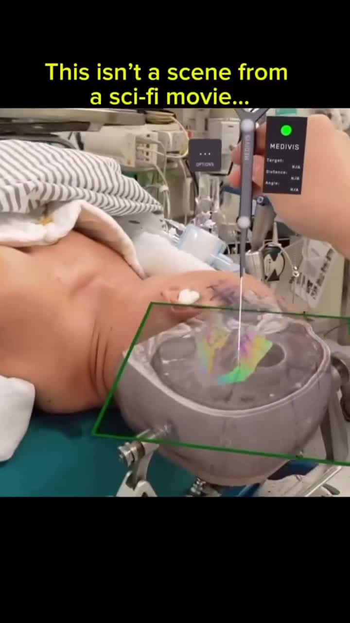 Cover for Augmented reality is revolutionizing neurosurgery! Surgeons can now navigate the brain and spinal cord with unparalleled precision by overlaying MRI and CT scans directly into