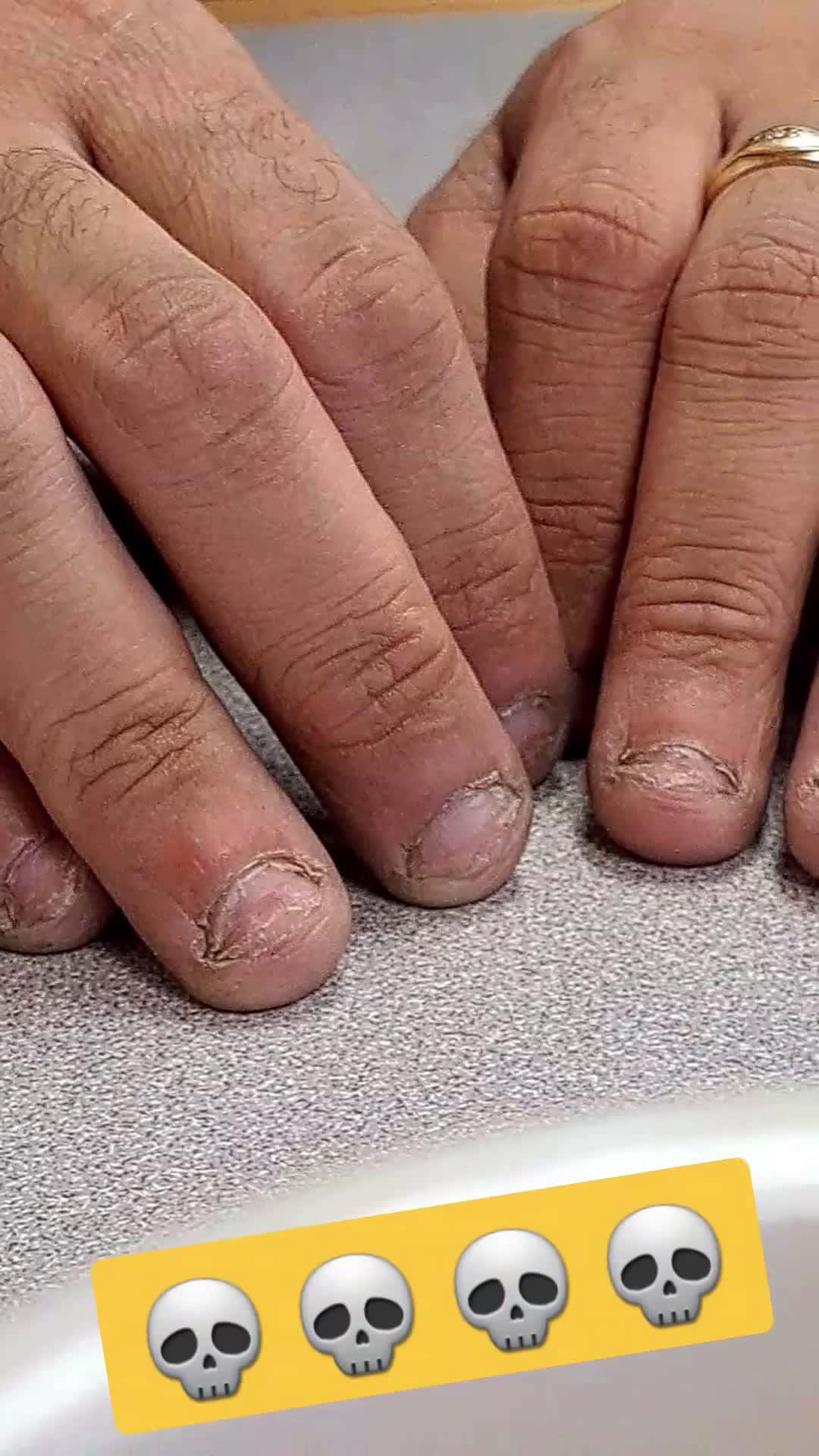 Cover for Questionable..what are those?...could you classify these as fingernails? 🤔💭🤣 #viral #fyp #nails #follow 