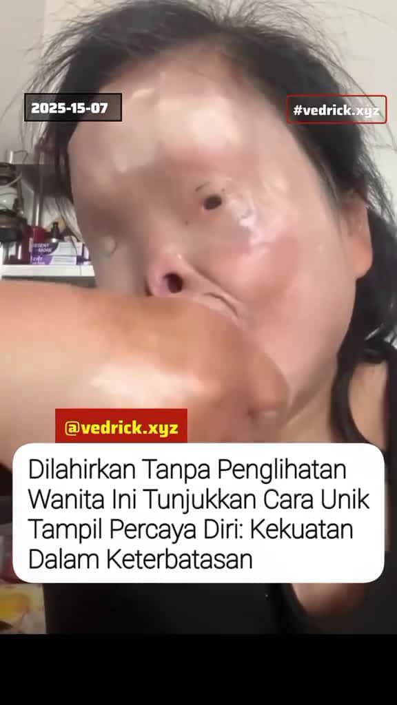 Cover for Terlahir tanpa penglihatan bukan berarti hidup harus terbatas. Wanita hebat ini m 75398 #shortvideos