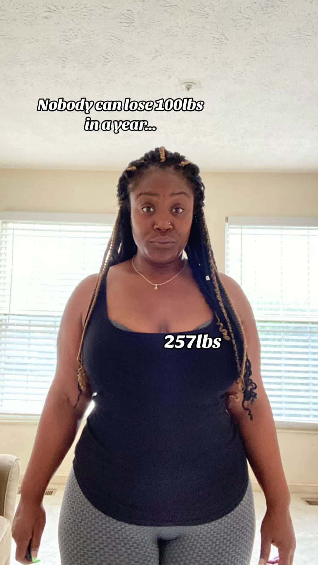 Cover for The gasps 😲i get🤗#fyp #sound #trendingsound #beforeandafter #weightloss #transformation #sleevegastrectomy #wls #viral
