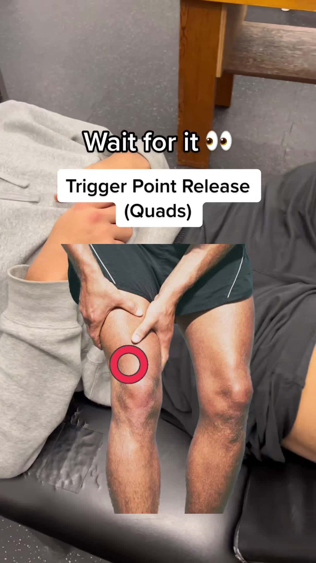 Cover for Trigger point release for the quads #physicaltherapy #physiomike #triggerpoint #trigger #fyp