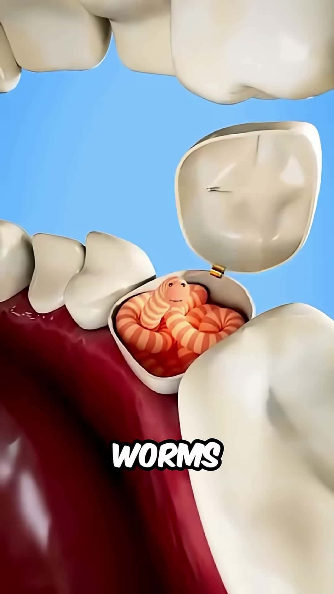 Cover for How To Prevent Worms In Your Teeth