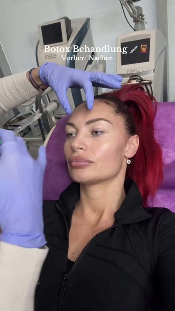 Cover for Come with me Botox Behandlung   Come with me zur Botox Behandlung Ich pershnlich  93142 #nicevideo