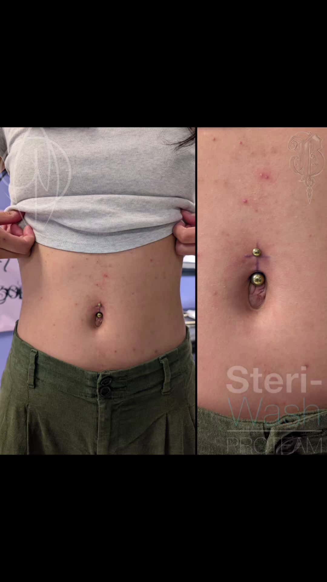 Cover for Navel piercings on a couple of besties the other day.Steri-Wash Blackwork Supply PhucStyx TattooSupply #navel #navelpiercing #bellybuttonpiercing #bodypiercings #piercing #piercings #pierced #steriwash #steriwashproteam #bla