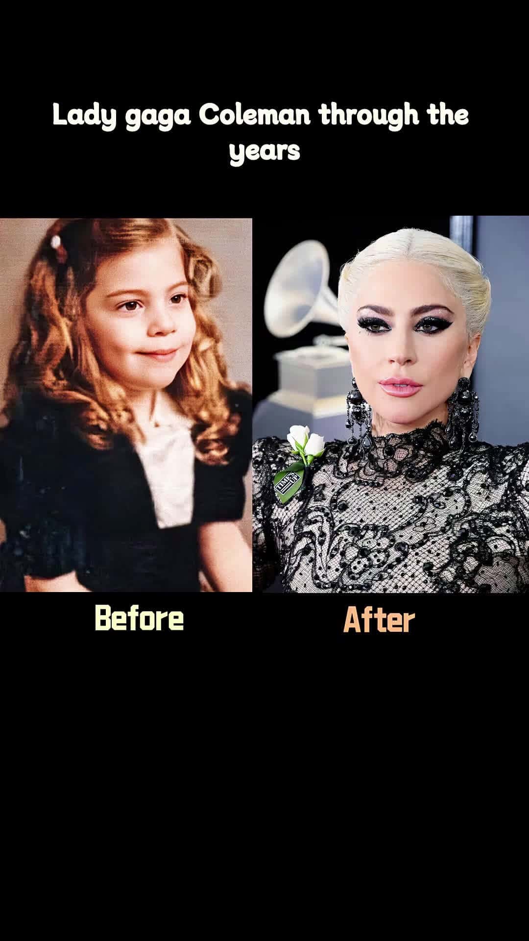 Cover for #CaughtOnCamera Lady gaga Coleman through the years #celebrities #hollywood #us #celebrity #foryou #movie #actors #fyp #viral 