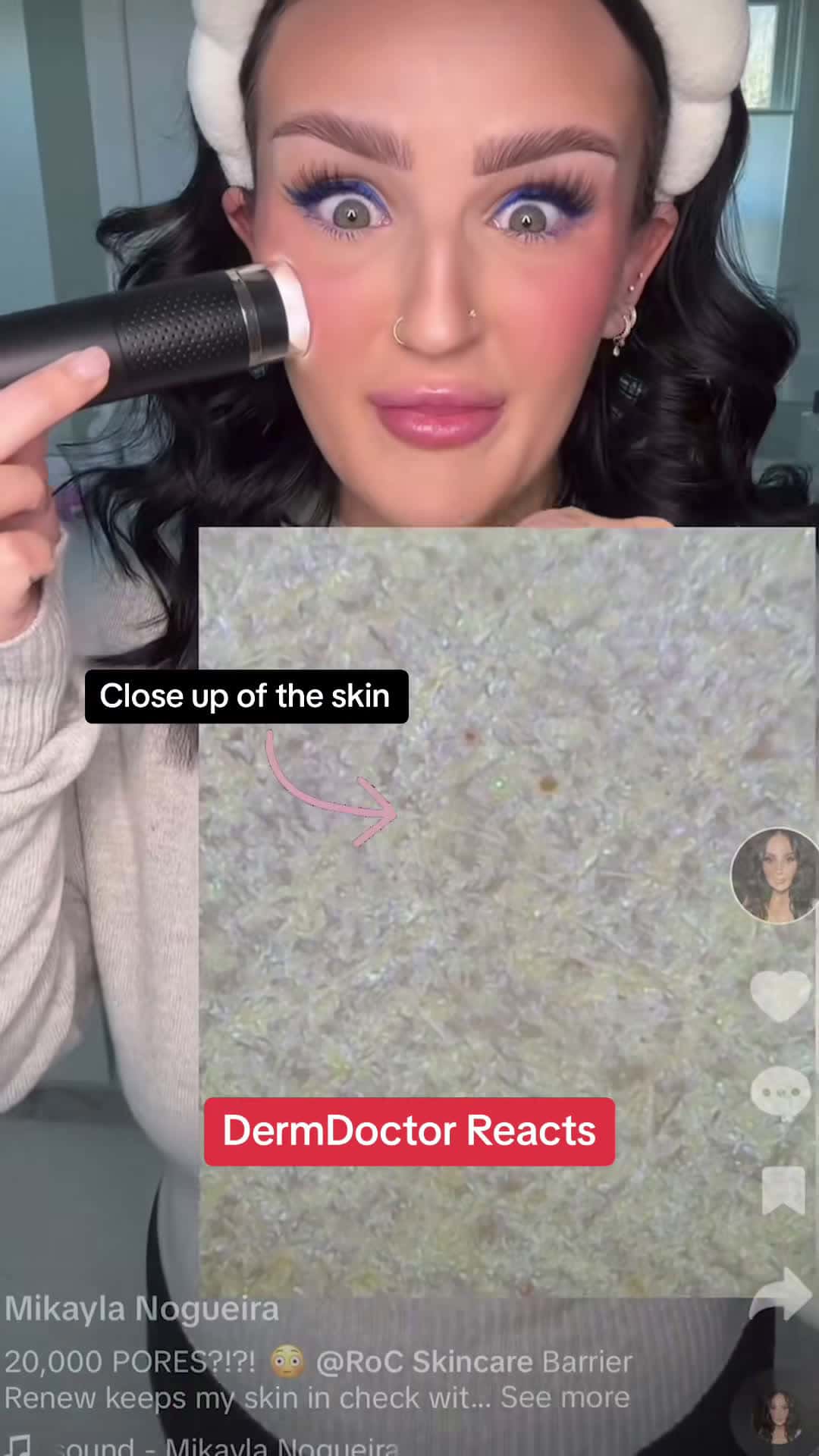 Cover for Pores 101: How to keep them clean while maintaining a healthy barrier🧼 @RoC Skincare #rocpartner #20Kcleanse #dermdoctor #skincare #pores #barrierrenew