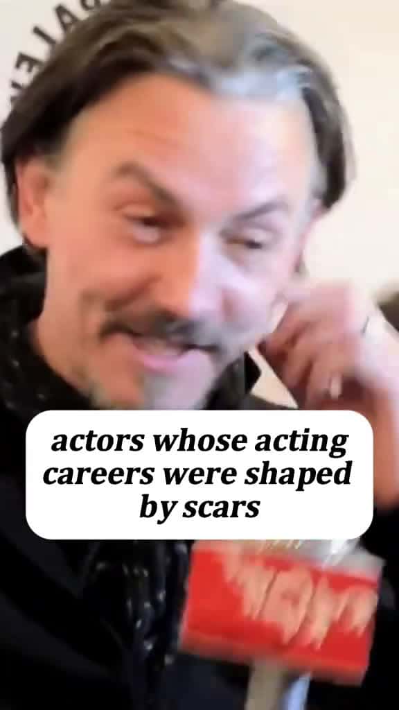 Cover for #CaughtOnCamera Four actors whose acting careers were shaped by scars #celebrity #celeb #art #cute #movie #influencer #news #makeup #instadaily #star #likeforlikes #celebrityfashion #movies #celebrities #style #music #explore #foryoupage #fyp #viral 