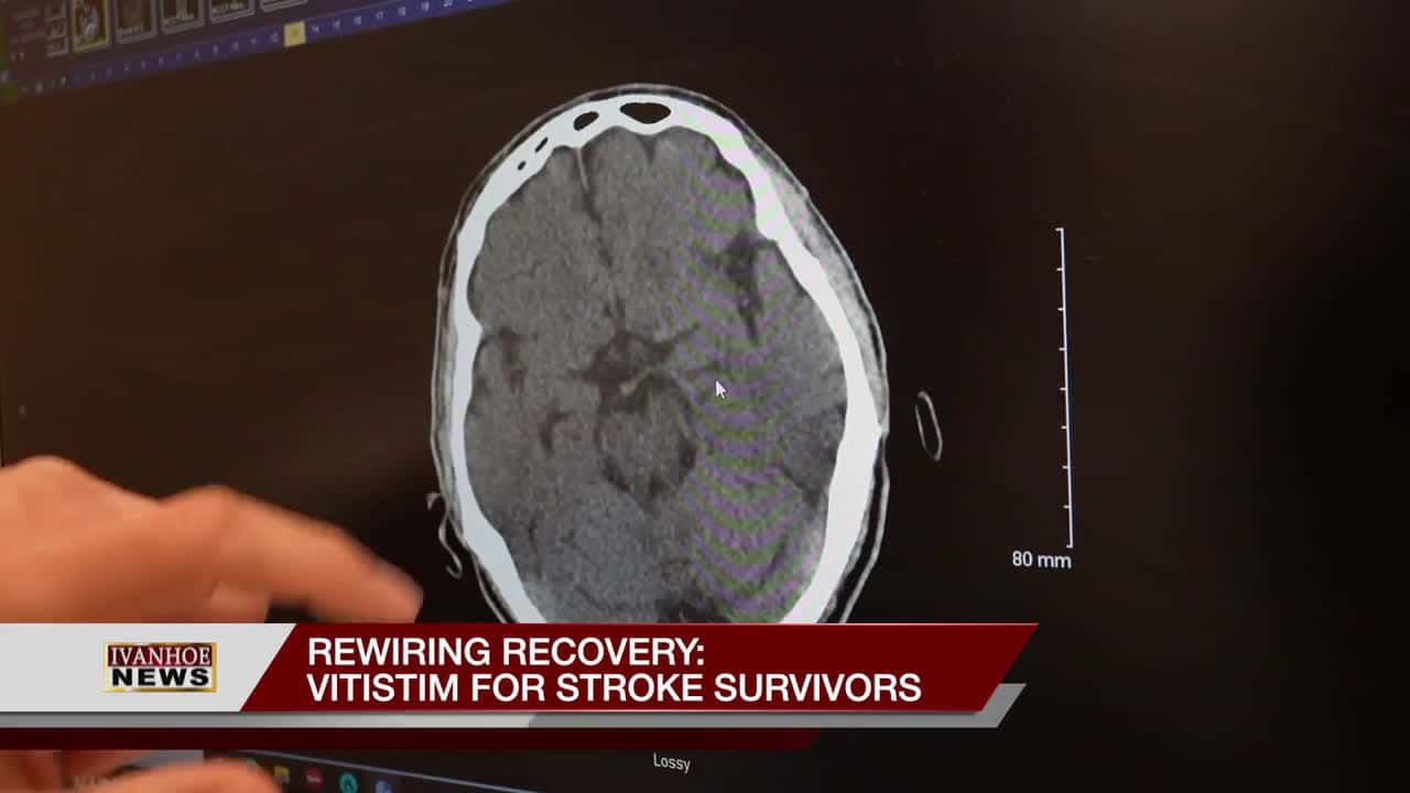 Cover for Rewiring Recovery: Vivistim for Stroke Survivors