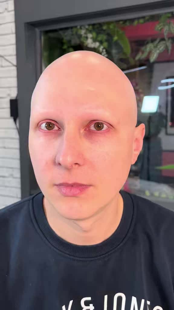 Cover for Watch this amazing hyperrealistic eyebrow tattoo transformation for alopecia! Full process from bare to bold brows. 💖 #BrowTransformation #AlopeciaAwareness #Hyperrealism