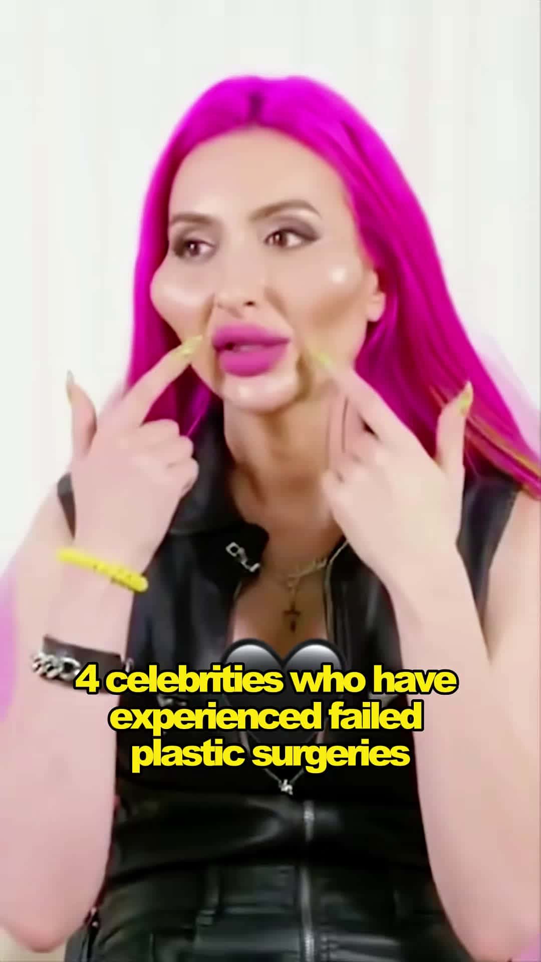 Cover for #CaughtOnCamera 4 celebrities who have experienced failed plastic surgeries... #celebrity #celeb #art #cute #movie #influencer #news #makeup #instadaily #star #likeforlikes #celebrityfashion #movies #celebrities #style #music #explore #foryoupage #fyp #viral 
