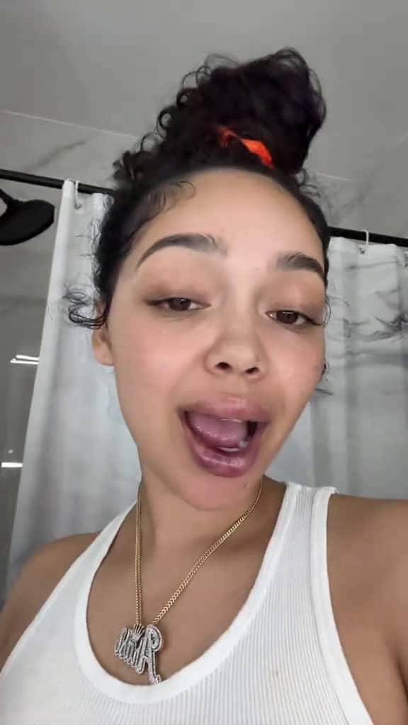 Cover for '🙂 #foryou #lipfillers #biglips' by Queen👑✨