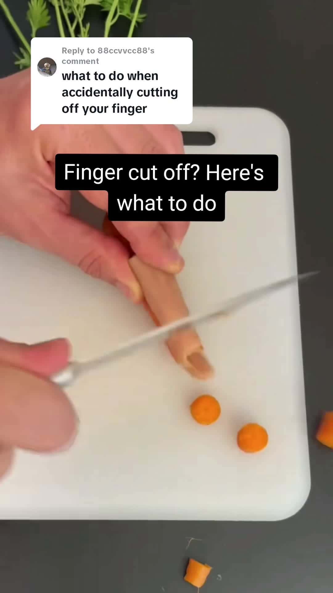 Cover for Replying to @88ccvvcc88 What to do when you accidently chop a finger 🖕 #learnontiktok #emergencysurvivakit #emergencytips #firstaid #survivaltips #fyp