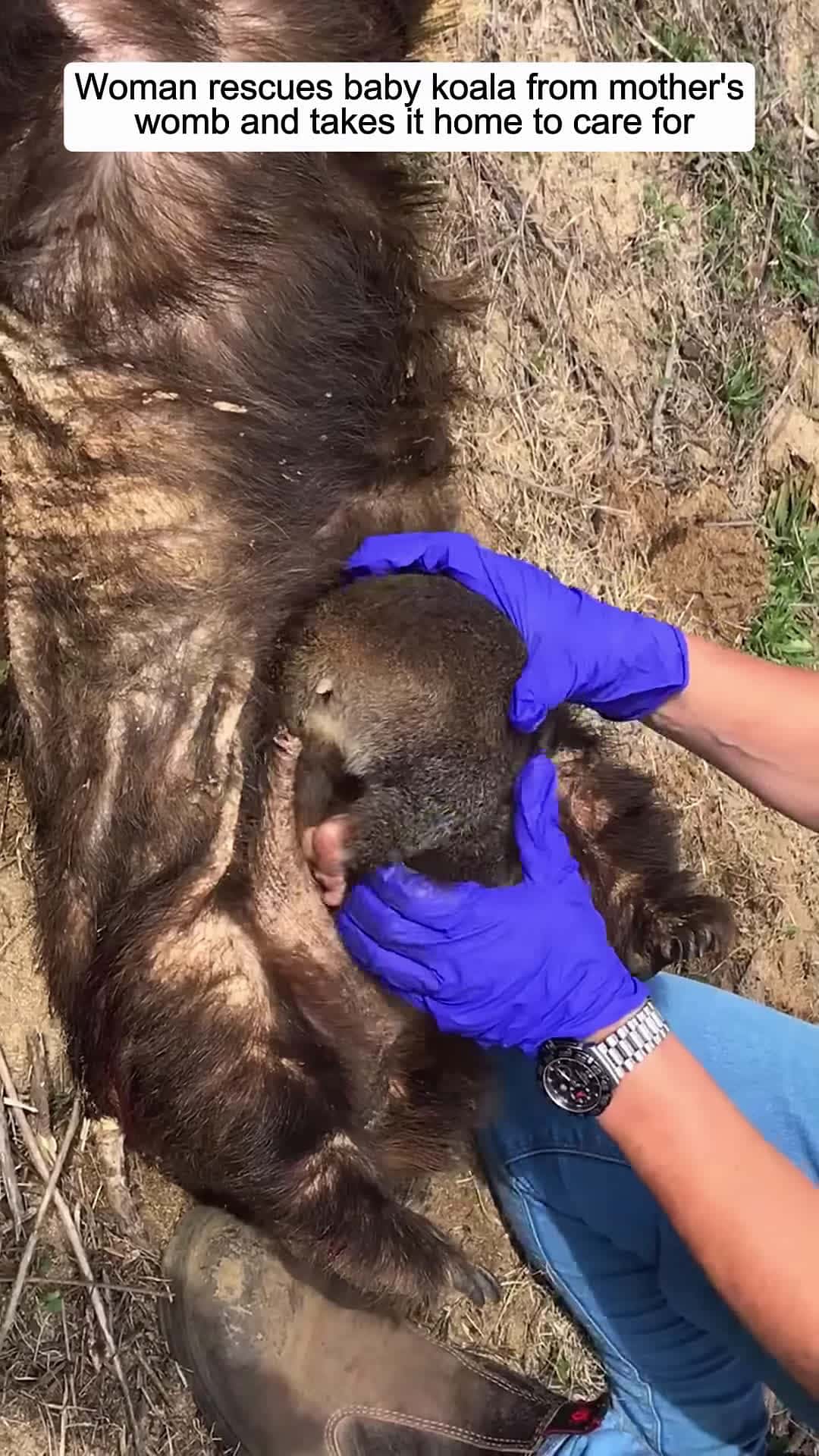 Cover for Woman rescues baby koala from mothers womb and takes it home to care for animalshorts