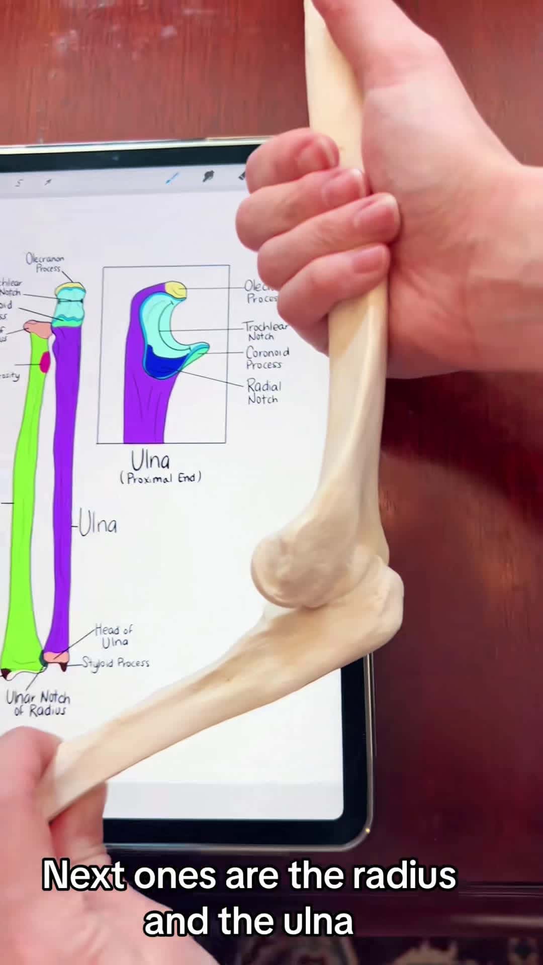 Cover for Bones & Bone Markings- Ulna, Radius, Elbow Joint #bones #ulna #radius #elbowjoint #skeleton #skeletalsystem #anatomy #sciencetok #anatomylab #nursingschool #nursingstudent #medstudent #anatomyclass #study #anatomylesson #anatomyandphysiology #anatomyteacher #studytok