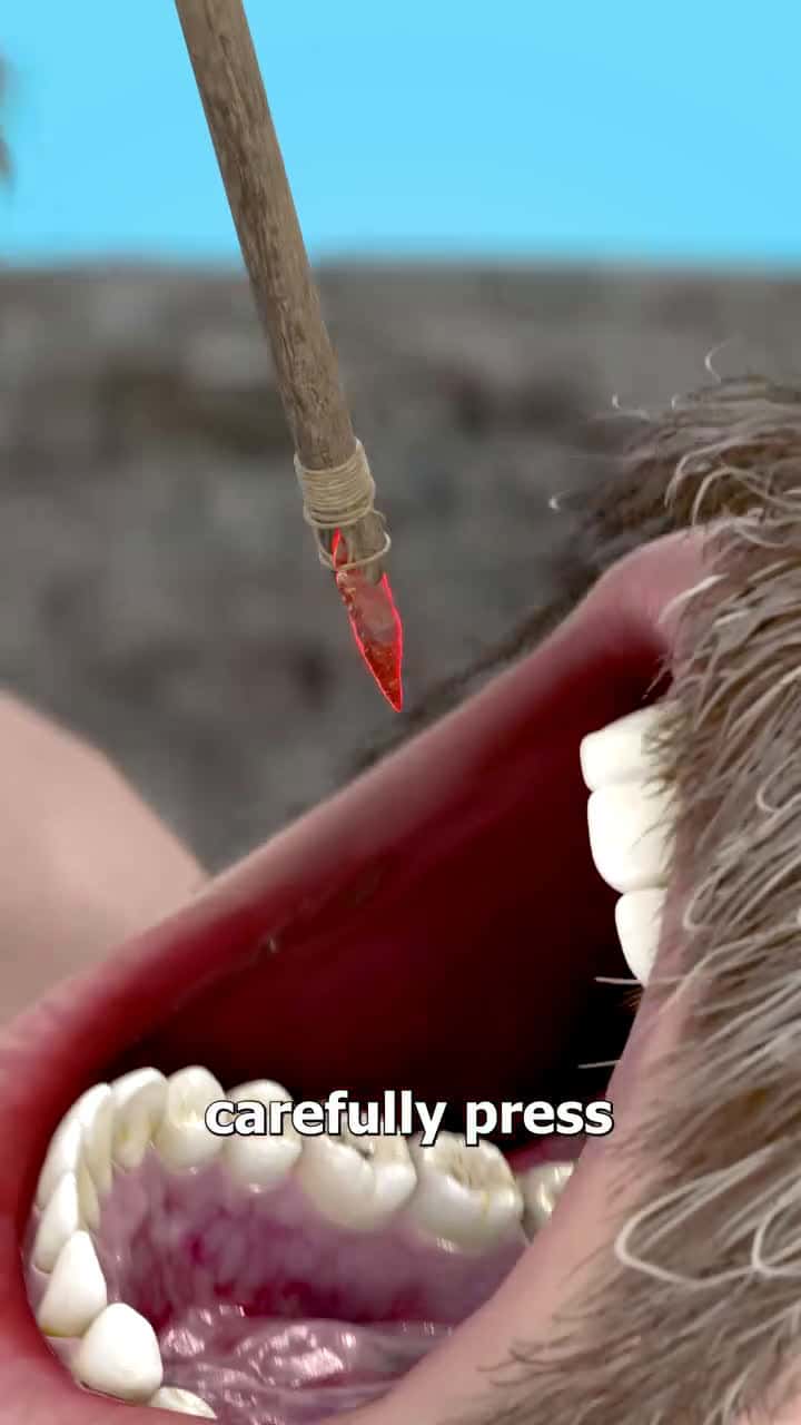 Cover for Tooth Drilling Before Anesthesia 😖
