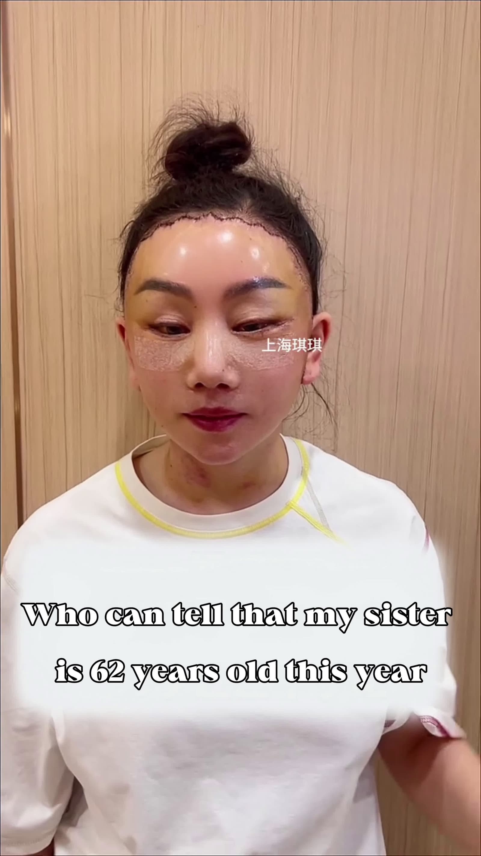 cover for 61 year old facelift surgery #Young face #anti-aging