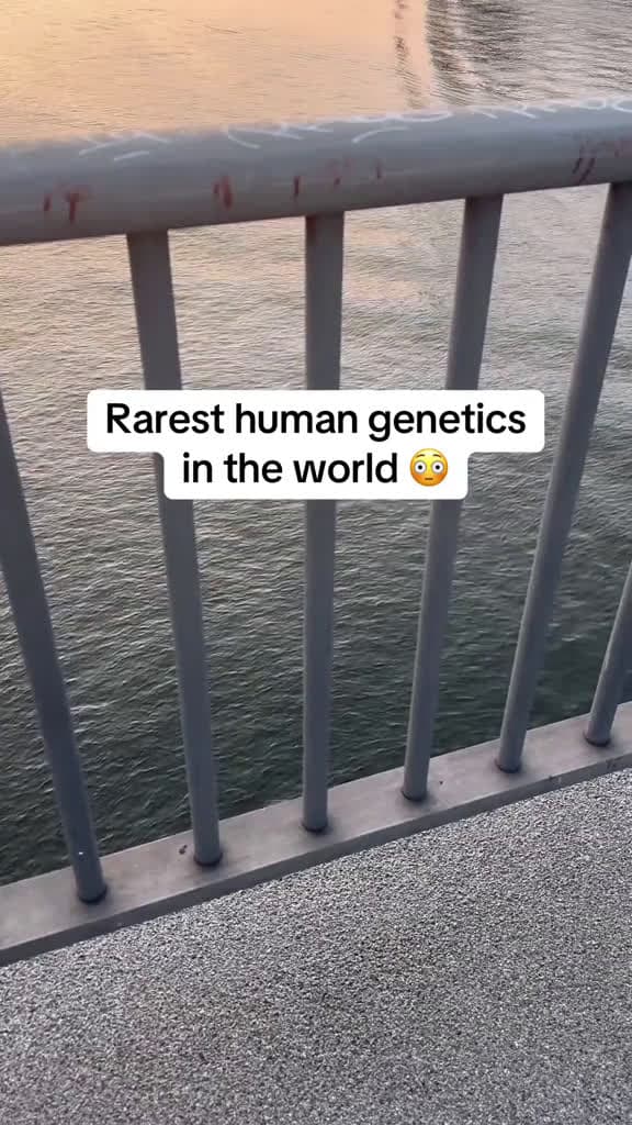 cover for Rarerest human genetics in the world🧐😮