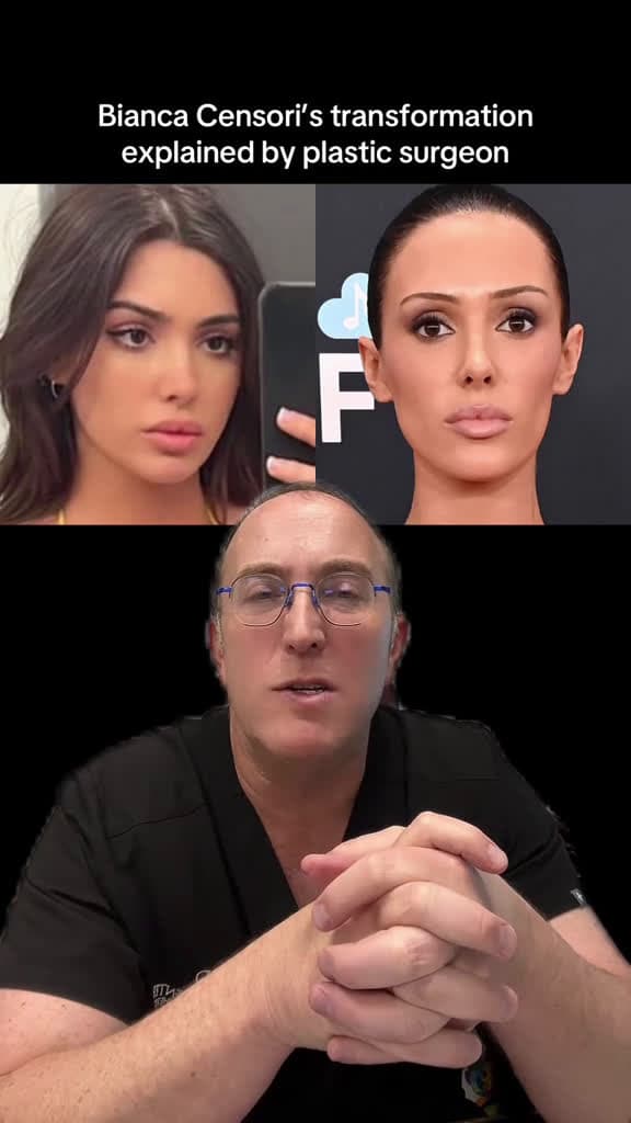 cover for Bianca Censori's Bold Grammys Transformation Revealed