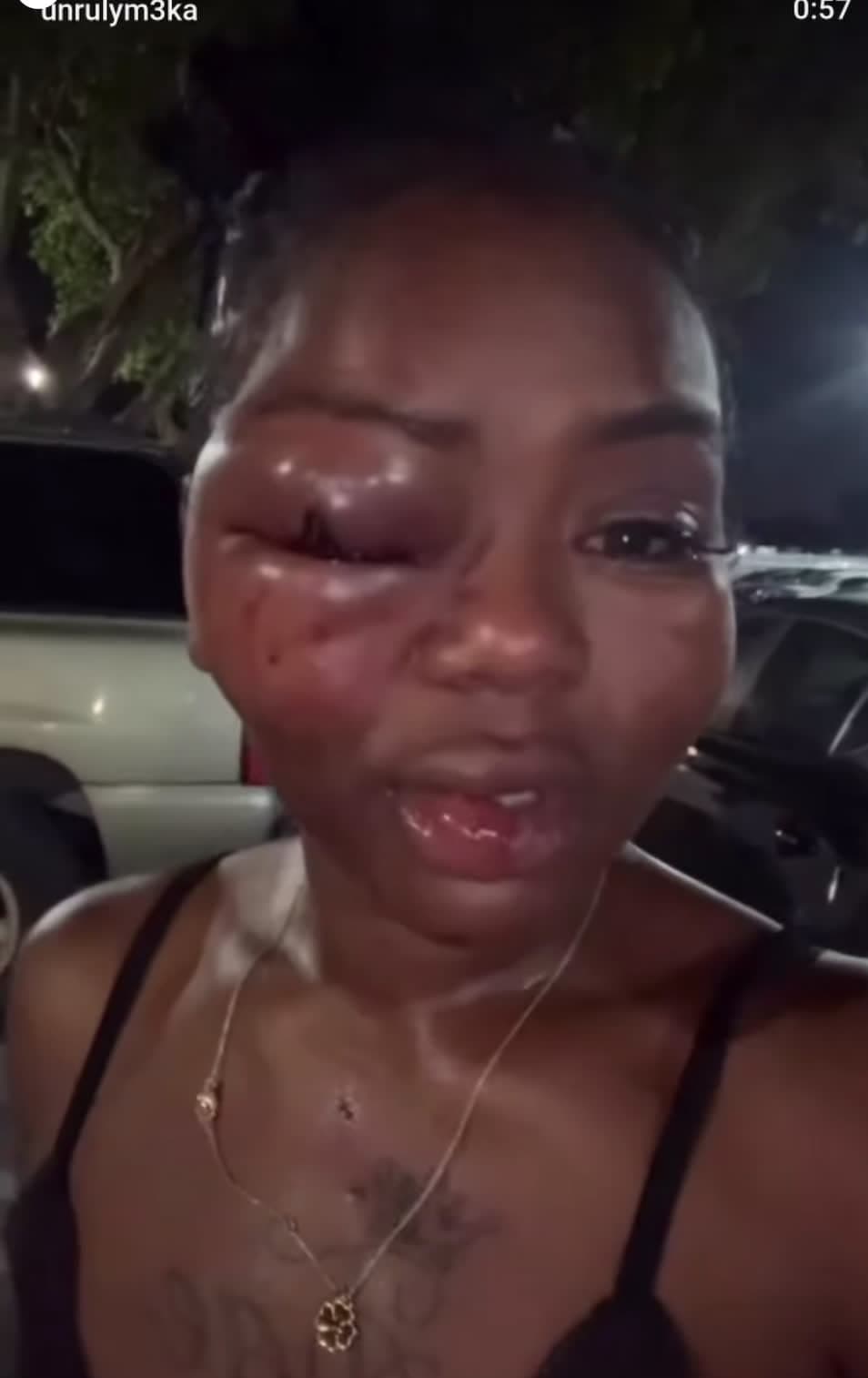 cover for #TrueCrimeStories  so backstory she was at the club ended up having a fight with a girl she was putting BTA and the other girl boyfriend pistol whipped her yall men are cowards