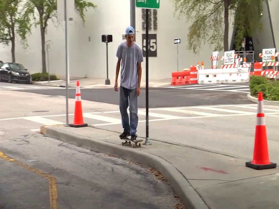 cover for Manny with three noses leaves everyone speechless 👃 #weird #viral #Manny #amazing