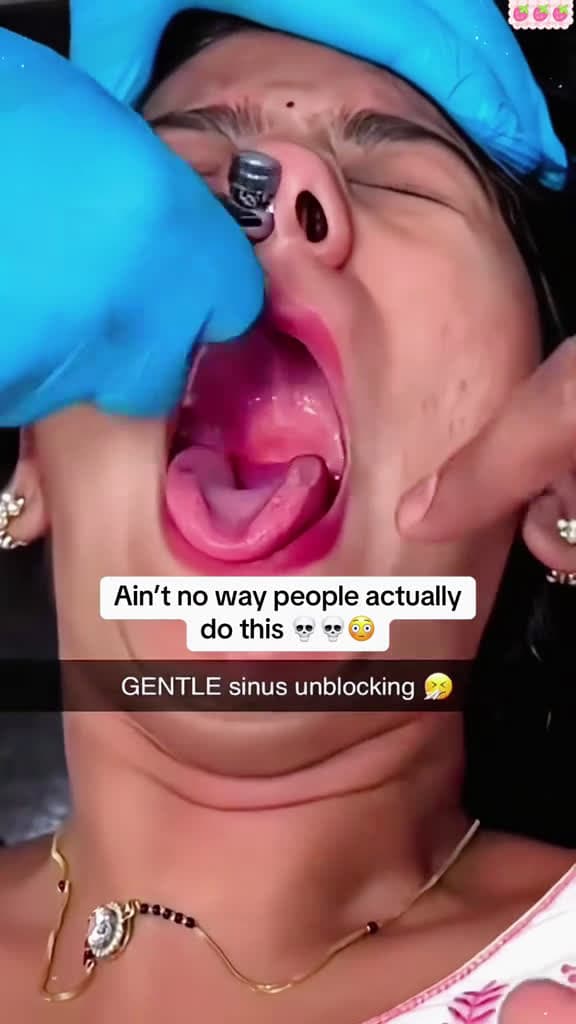 cover for Unclogging a stuffy nose fyp funnyvideo funny funnytiktok funnyprank hahaha funnymoments t 22027 #followMe