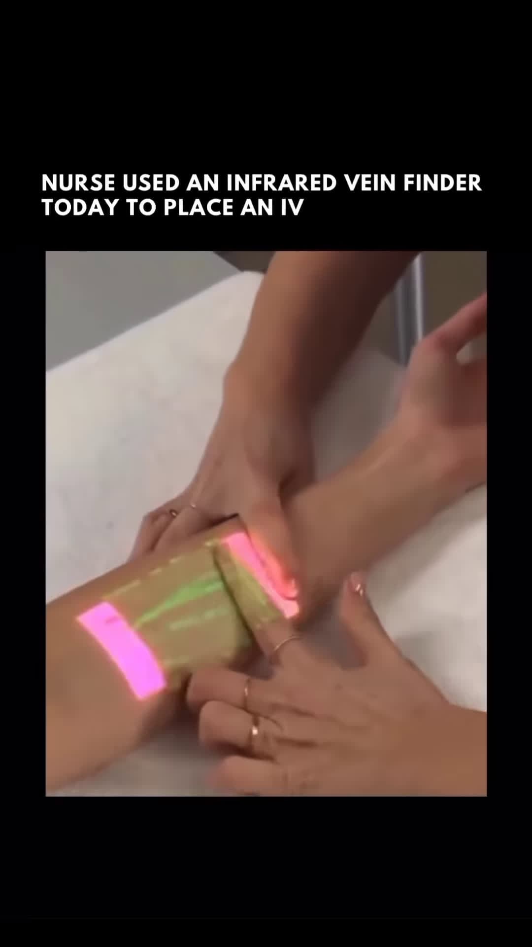 cover for Certainly! A vein finder uses infrared light to locate veins beneath the skin It emits near - infrared light, which is absorbed by hemoglobin in the blood Veins appear as dark