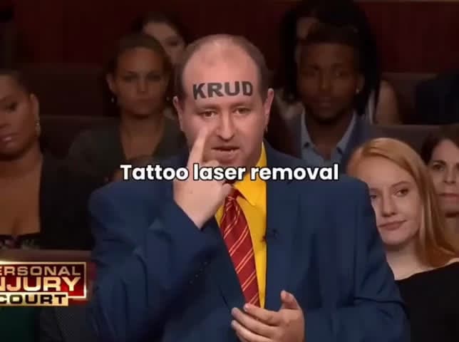 cover for He got a $250k forehead tattoo, then sued for $510k?! 💰😲 #TattooDrama #CrazyLawsuit #FaceTattoo #MoneyMoves