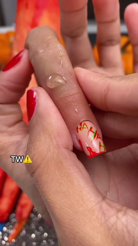 cover for Finger Removal (@amputee.barbie collab) #nails #nailtutorial #acrylicnails #beautyhacks #scoopz  #viral 