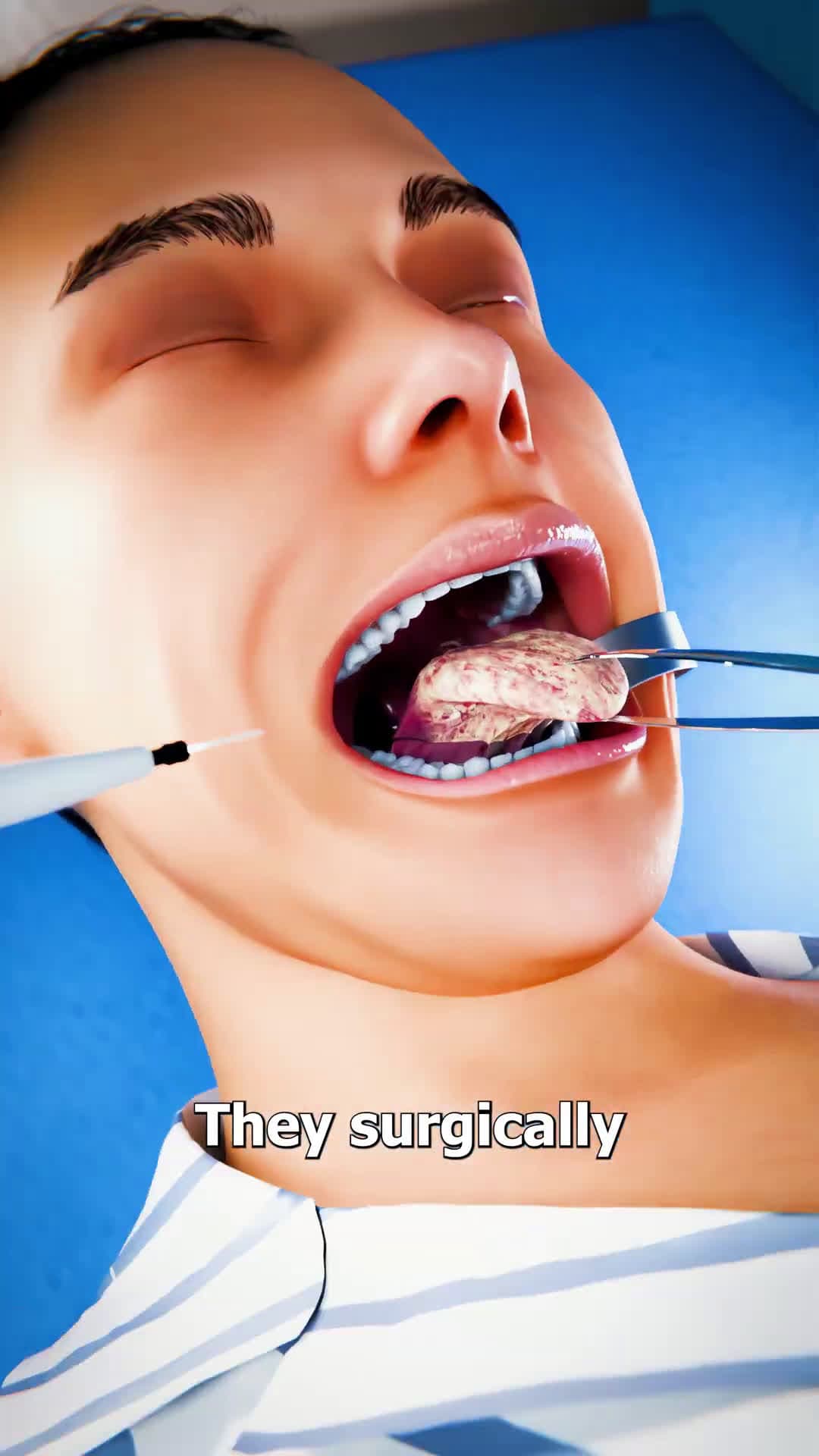 cover for They Built A Tongue From Her Arm Muscle 😮