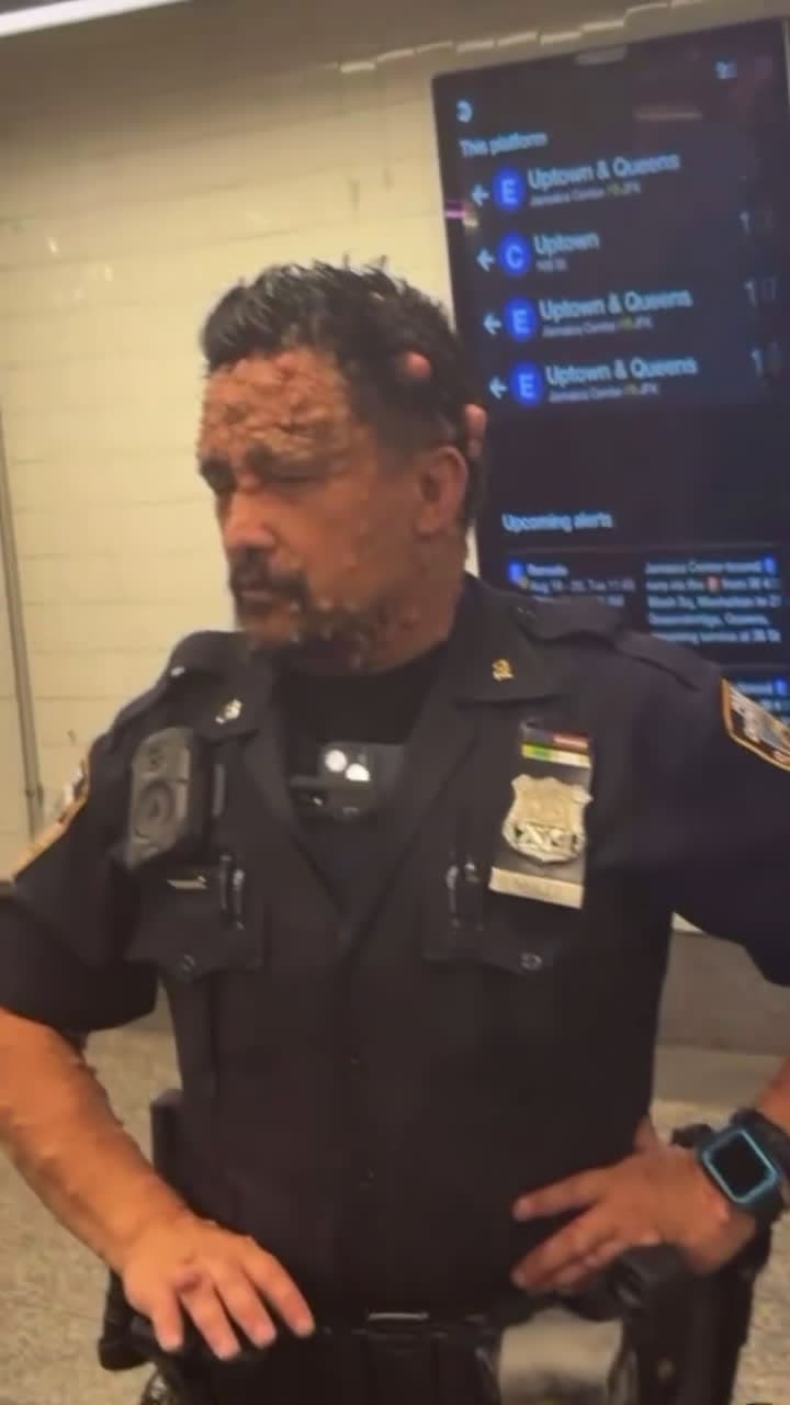 cover for NYPD cop with a crazy skin condition 