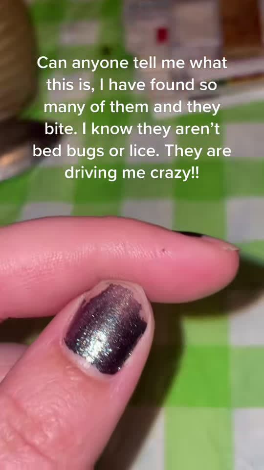cover for Mystery bugs with a painful bite 😰 Can anyone identify them? #bugbite #itchy #help 🙏