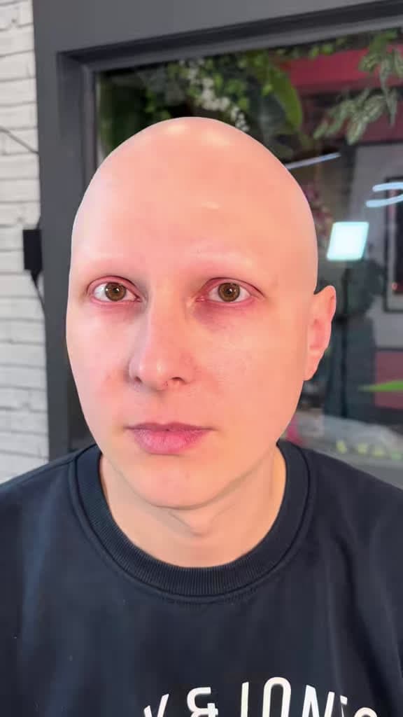 cover for Watch this amazing hyperrealistic eyebrow tattoo transformation for alopecia! Full process from bare to bold brows. 💖 #BrowTransformation #AlopeciaAwareness #Hyperrealism