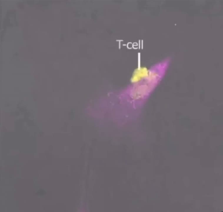 cover for Watch a T-Cell wipe out a cancer cell in real time 🧬🔥 #Immunotherapy #CancerResearch #TCell #Biotech