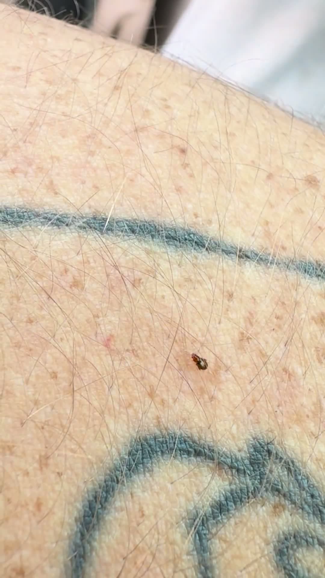 cover for Is this a flea? Found in New Jersey 🐜 #FleaIdentification #NJ #Insects