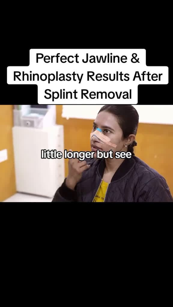 cover for Day -12 Perfect Jawline Rhinoplasty Results After Splint Removal Day12Update JawlineGoals 02656 #trendingscoopz